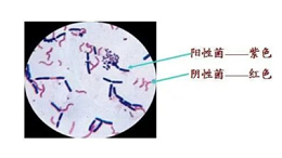 猪病毒性疾病与细菌性疾病常见病的区分-上海邦森